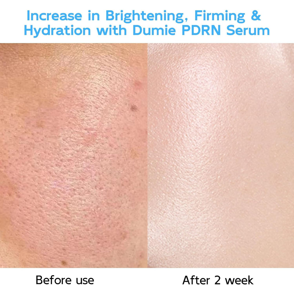 Salmon DNA PDRN Anti-Aging Serum with 5000ppm Salmon Egg DNA, 2000ppm Collagen, Glutathione, Niacinamide, and Six Hyaluronic Acids - Korean Skincare Solution for Wrinkles and Radiance, 0.05 Fl. Oz x 30 Units