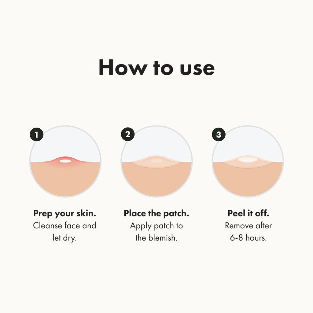 Hero Cosmetics Original Hydrocolloid Acne Pimple Patch – Effective Spot Treatment for Zits and Whiteheads, 36 Count