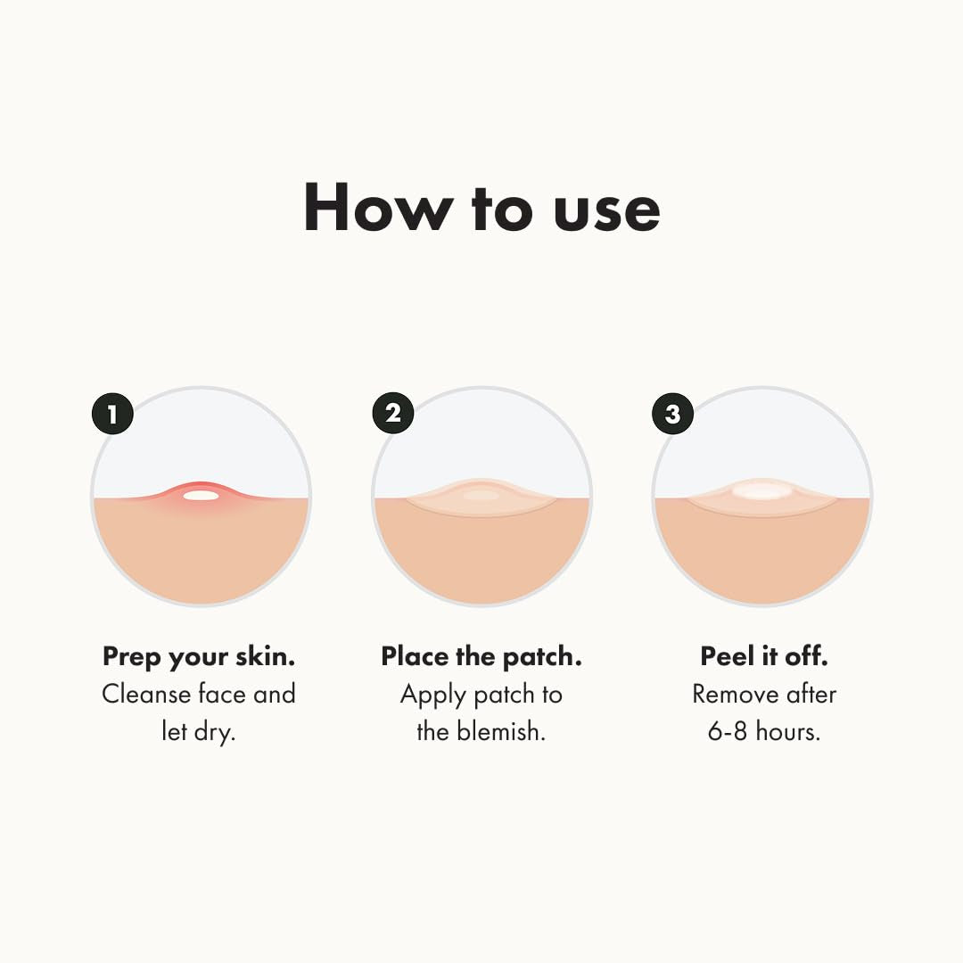 Hero Cosmetics Original Hydrocolloid Acne Pimple Patch – Effective Spot Treatment for Zits and Whiteheads, 36 Count